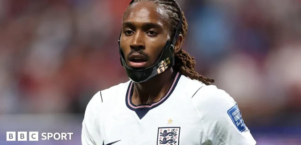 Jugador de Inglaterra con máscara durante el partido Jugador de Inglaterra con máscara durante el partido